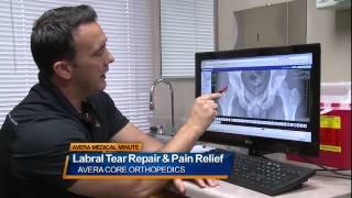 Labral tear repair and pain relief  Medical Minute [upl. by Eeramit]