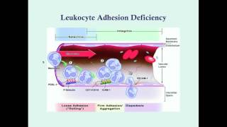 Leukocyte Adhesion Deficiency  CRASH Medical Review Series [upl. by Tidwell]