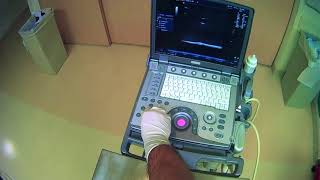 How Does an Ultrasound Works [upl. by Ruiz771]