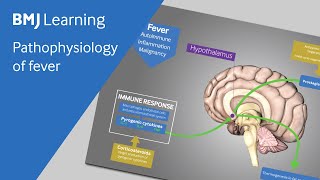 Pathophysiology of fever explained [upl. by Yniatirb818]