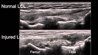 Knee joint structure and actions [upl. by Couhp]