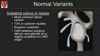 Imaging of the Glenoid Labrum Location Matters By Michelle Nguyen MD [upl. by Nywra]