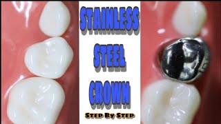 Stainless Steel Crown  Step By Step [upl. by Irv]