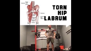 Torn Hip Labrum DO THIS NOW  SmashweRx  Trevor Bachmeyer [upl. by Eejan]