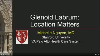 Stanford Radiology quotGlenoid Labrum Location mattersquot by Michelle Nguyen MD [upl. by Dine541]